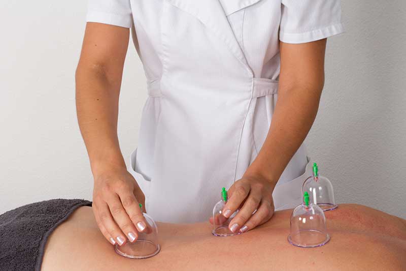 What I Learned From My First Cupping For Herniated Disc Session