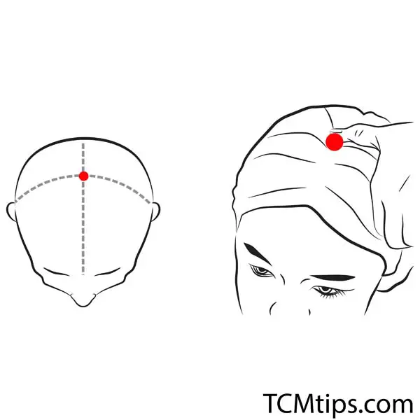 Acupoint: GV-20 (Other Names: The Governing Vessel-20/Bai Hui/Hundred Convergence)