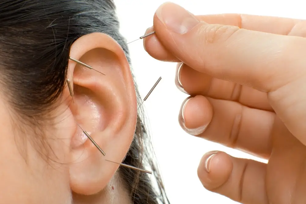 Acupuncture Ear Seeds Points