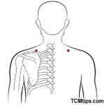 4 Acupressure Points For Trapezius Pain You Need To Know - Easy TCM ...