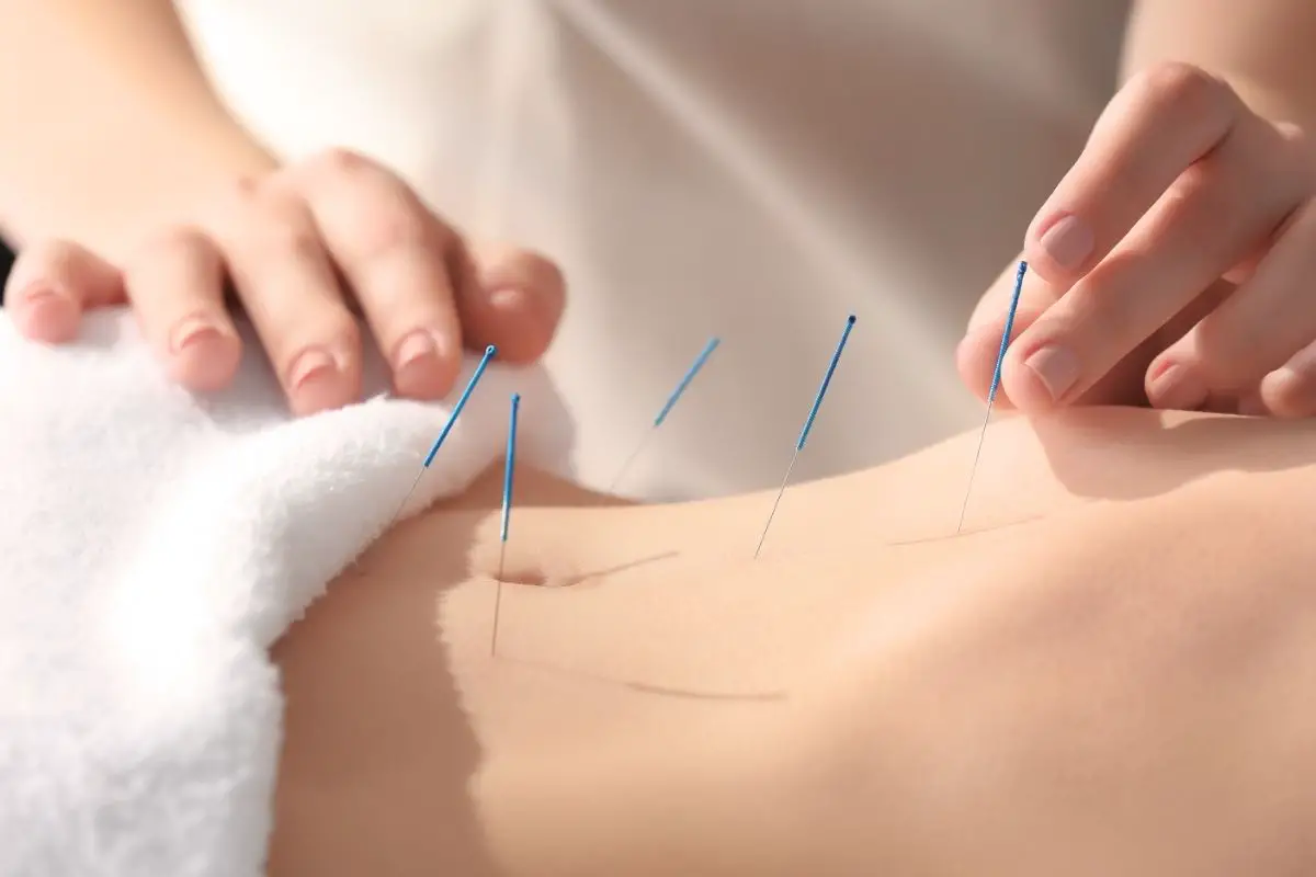 How To Heal A Pinched Nerve With An Acupuncture Pen