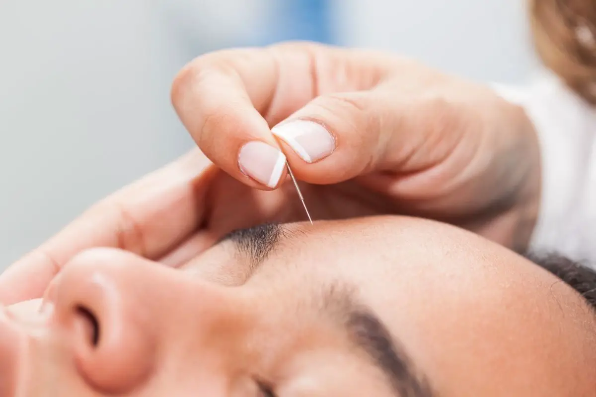 How To Use Acupuncture Pen On Face