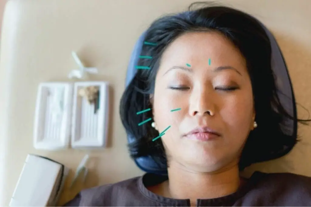 10 Best Acupuncture Clinics In Fort Collins Easy TCM Wisdom Your