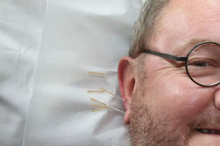 The 5 Best Acupuncture Clinics In Atlanta Easy TCM Wisdom Your Path
