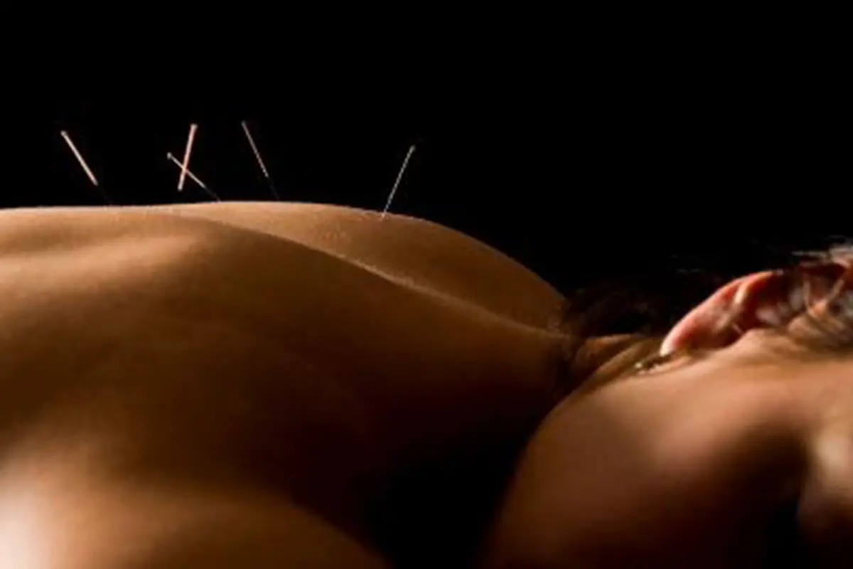 Han Acupuncture