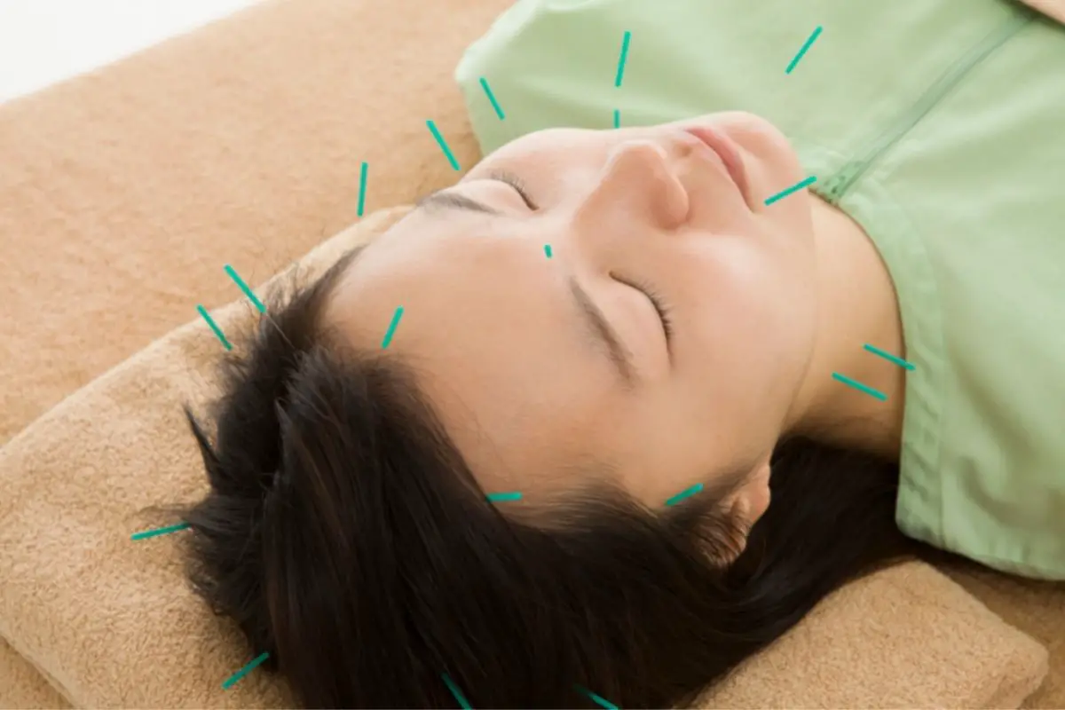 Pinon Community Acupuncture