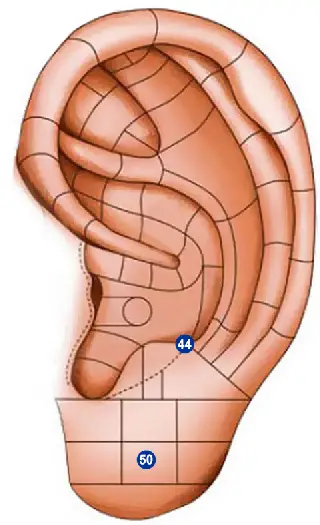 ear seeds placement for anxiety